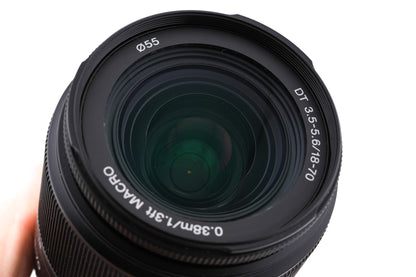 Sony 18-70mm f3.5-5.6 DT Macro